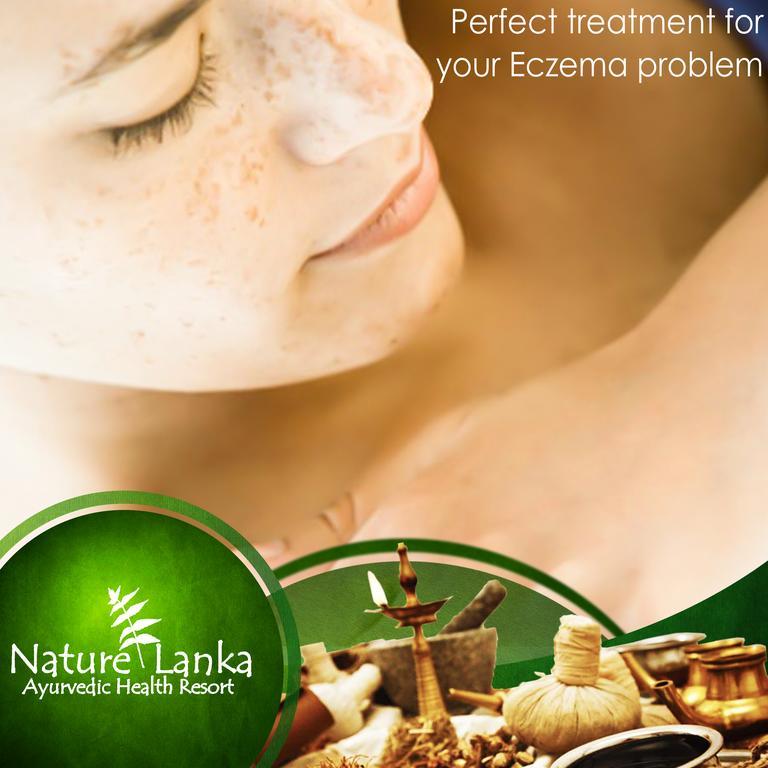 Nature Lanka Ayurveda Resort - All Meals And Ayurveda Treatments With Yoga Tangalle Exteriör bild